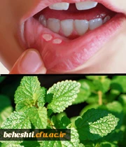 10 گیاه ضددرد را بشناسید