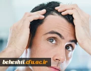 وقتی که ریزش مو ارثی نیست